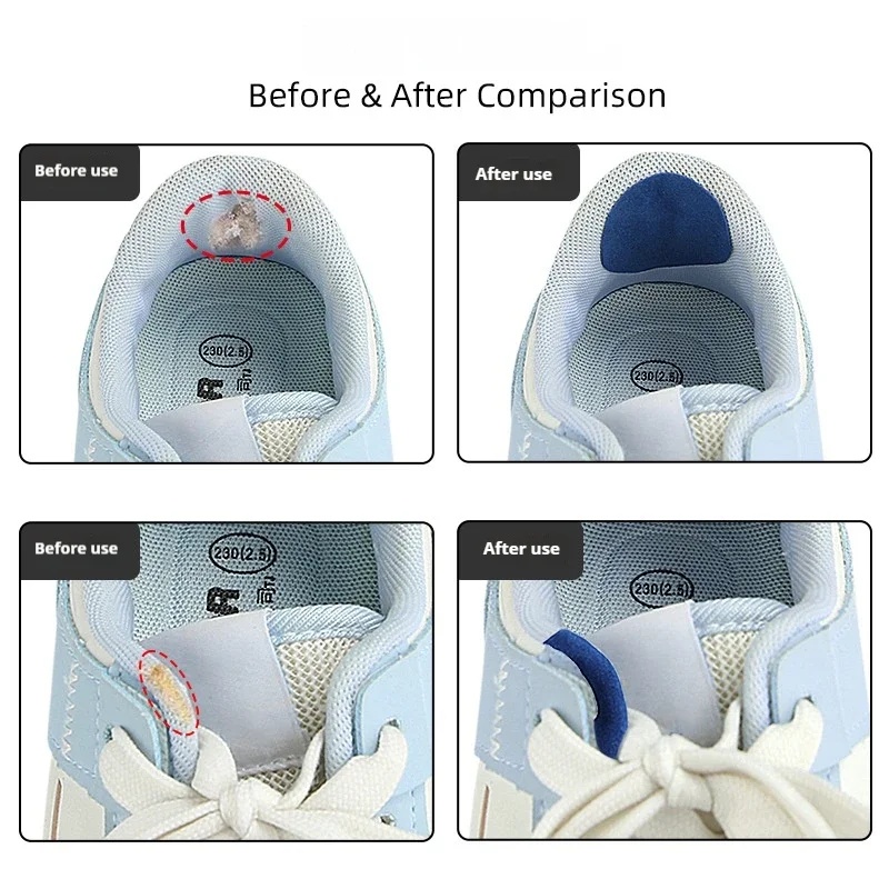 손상된 측면 가장자리, 내부 안감 및 발뒤꿈치 마모 방 - Sports Equipment Repair 리뷰 및 가격